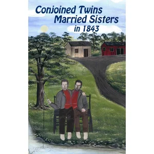 Conjoined Twins Married Sisters in 1843